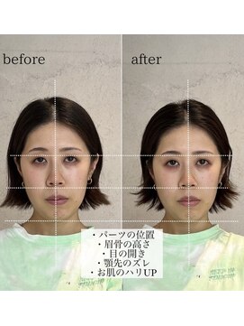 ロルド レーブ(Rold reve) 小顔メニュー