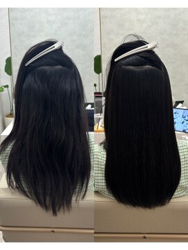 シンズ 銀座(sins) クセにより頭が大きくみえるお悩み[30代40代50代60代]