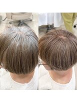 ロテ(Rote)&nbsp;脱白髪染め