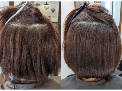 コロン(coron)の写真