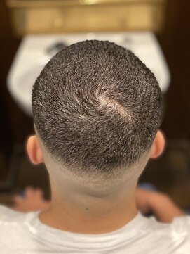 ヒロギンザ 横浜店(HIRO GINZA) ニグロスキン