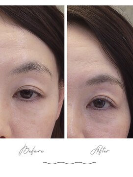キッカ(Kikka) プロに任せる眉習慣