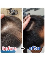 ルーミールーム(RoomieRoom)&nbsp;お悩み解決☆頭皮改善！育毛促進ケア