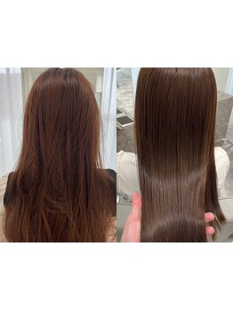 【覚王山/本山】本物志向の大人女性から支持を集める!美しさを保つ為にあなたに合った施術をご提案します♪