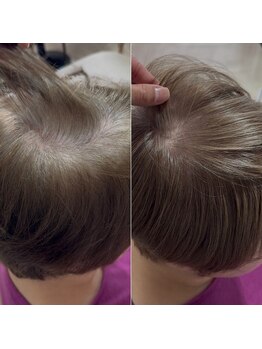 エメ(aimer)の写真/白髪ぼかしを始めてみせんか?白髪を生かして若々しく見せる弘前唯一の白髪ぼかしカラー技術◎