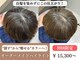 ハロウ 天神(Halou)の写真