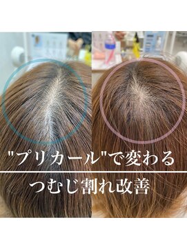 ロミー 本厚木(ROMMY.) 【オール世代おすすめ】根本の立ち上がりプリカール割れ目解消