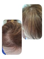 ユーフォルムギンザ(y-Forme Ginza)&nbsp;話題のトキカタ♪前髪編