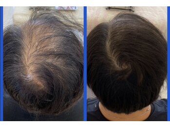 コニール(CoNeall)の写真/年齢に応じた髪悩みを気軽に相談！サロンケアとお家でのヘアケアで理想の髪へ