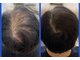 コニール(CoNeall)の写真/年齢に応じた髪悩みを気軽に相談！サロンケアとお家でのヘアケアで理想の髪へ