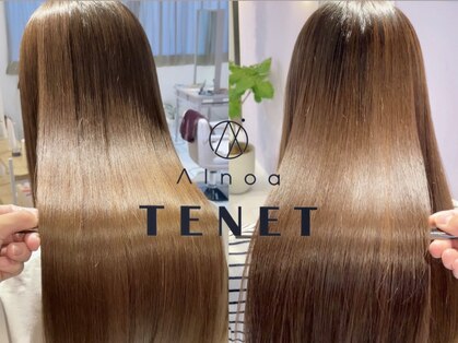 アイノアテネット(AInoa TENET)の写真