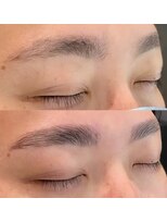 バブルー(bubblue)&nbsp;メンズハリウッドブロウリフト