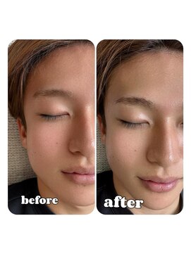 アルコ(ALCO) メンズ♪ハリウッドブロウリフト＆美眉スタイリング＆メイク