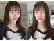 アトロ(Atoro)の写真