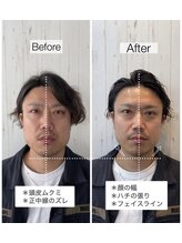 ザラメ(ZARAME)&nbsp;骨格補正スパ