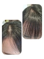 ユーフォルムギンザ(y-Forme Ginza)&nbsp;話題のトキカタ♪前髪編