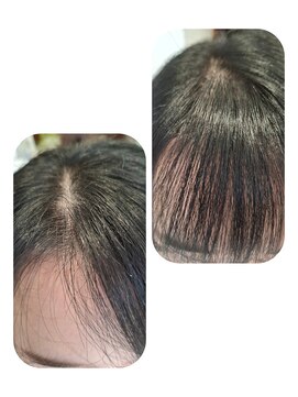 ユーフォルムギンザ(y-Forme Ginza) 話題のトキカタ♪前髪編