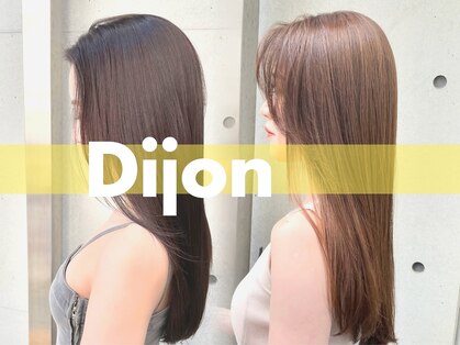 ディジョン(Dijon)の写真