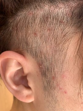 アクティフ(actif) 【頭皮改善・各種ヘッドスパ】名古屋の美容室actif MJ有紀