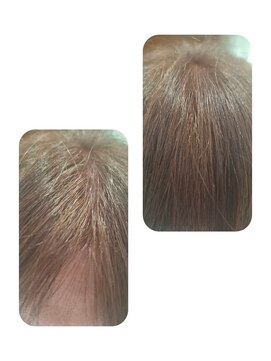 ユーフォルムギンザ(y-Forme Ginza) 話題のトキカタ♪前髪編