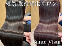 サンテ ヴィスタ(Sante ViSta)