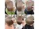 ピックアップ(pick up)の写真