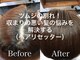 アンジュ(ange)の写真/第一印象を決める顔周りのカットで小顔見せ◎ヘアリセッターで生え癖や地割れのお悩みも解消♪