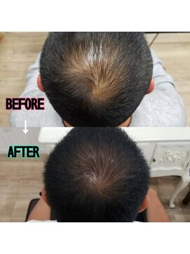 ルーミールーム(RoomieRoom) メンズ/当店史上最速で結果が出始めてきた方/ビフォーアフター