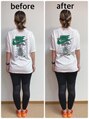 イジュ(iju)&nbsp;私も美容整骨で骨盤のゆがみ、O脚改善中です！