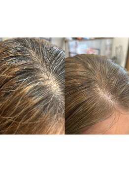 いつまでも楽しめる気分の上がるヘアスタイルに♪お悩みを解消×流行りのオシャレなスタイルが手に入る◎