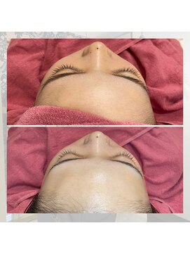 ヘアメイクエコー hair make echo レディースシェービング