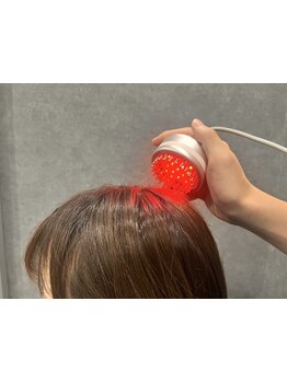 髪×頭皮のWケアでボリュームも艶もUP！最先端機器の頭皮診断から内側からのケアサポートまで◎