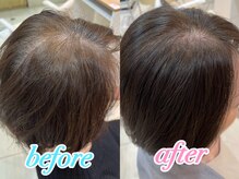 【よくあるお悩みをご紹介】ご来店されたお客様が抱えるお悩みをご紹介します。