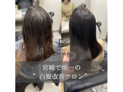 エマ(EMMA)の写真