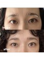 ドーター(daughter)&nbsp;眉でお困りがあれば改善されるよう施術していきます。
