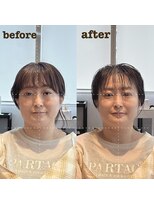 ザラメ(ZARAME) 骨格補正ベッドスパ