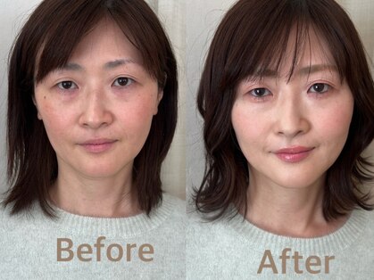 ソノ(sono)の写真