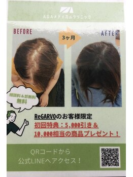 レガルボ(ReGARVO)の写真/薄くなり出した頭皮にヘッドスパと専門機関のケアを!健やかな頭皮環境へ導きます☆
