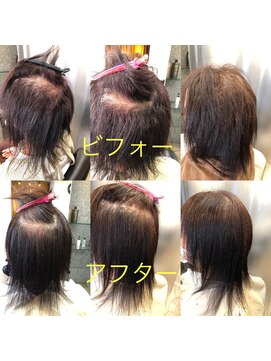 エノア 柏(ENORE) 弱酸性弱酸性矯正