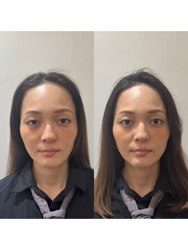 ラビリンス(Labyrinth) ヘッドスパ/髪質改善/トリートメント/強髪/リフトアップ