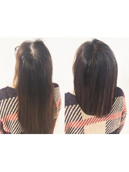 最先端のエクソソーム美容液で毛髪悩みの原因に根元からアプローチし、育毛促進やボリュームアップへ＊