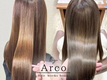 アルコ(Arco)