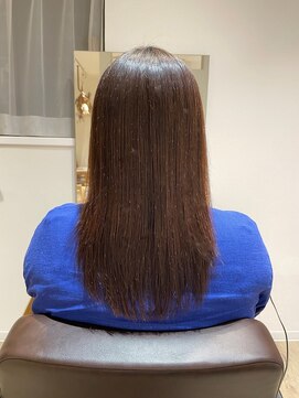 カミーノ 新越谷店(Camino) ソフト矯正のリアル ビフォア&アフター 3