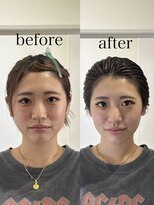 ヘアホスピタル ファニーフェイス(HAIR HOSPITAL funny face) 骨格補正ヘッドスパ・バランス小顔矯正/暗めカラー倉敷岡山