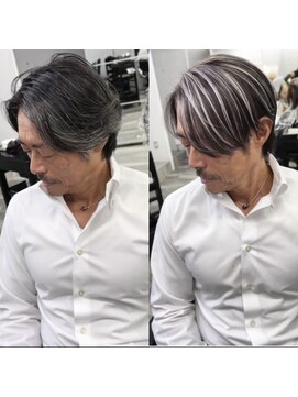 レディアル 大宮(REDEAL) 【白髪手術】イケおじ白髪手術/ハイライト