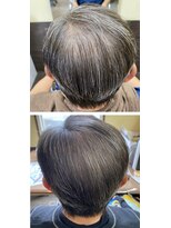 ヘアーメイク イソップ(Hair Make Aesop) 育毛促進