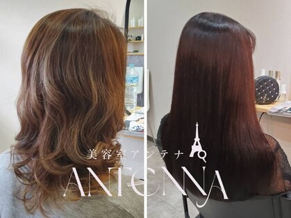 アンテナ(ANTENNA)の写真