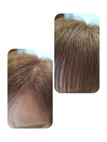 ユーフォルムギンザ(y-Forme Ginza) 話題のトキカタ♪前髪編