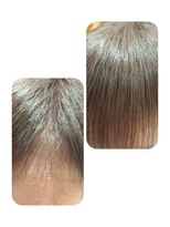 ユーフォルムギンザ(y-Forme Ginza)&nbsp;話題のトキカタ♪前髪編