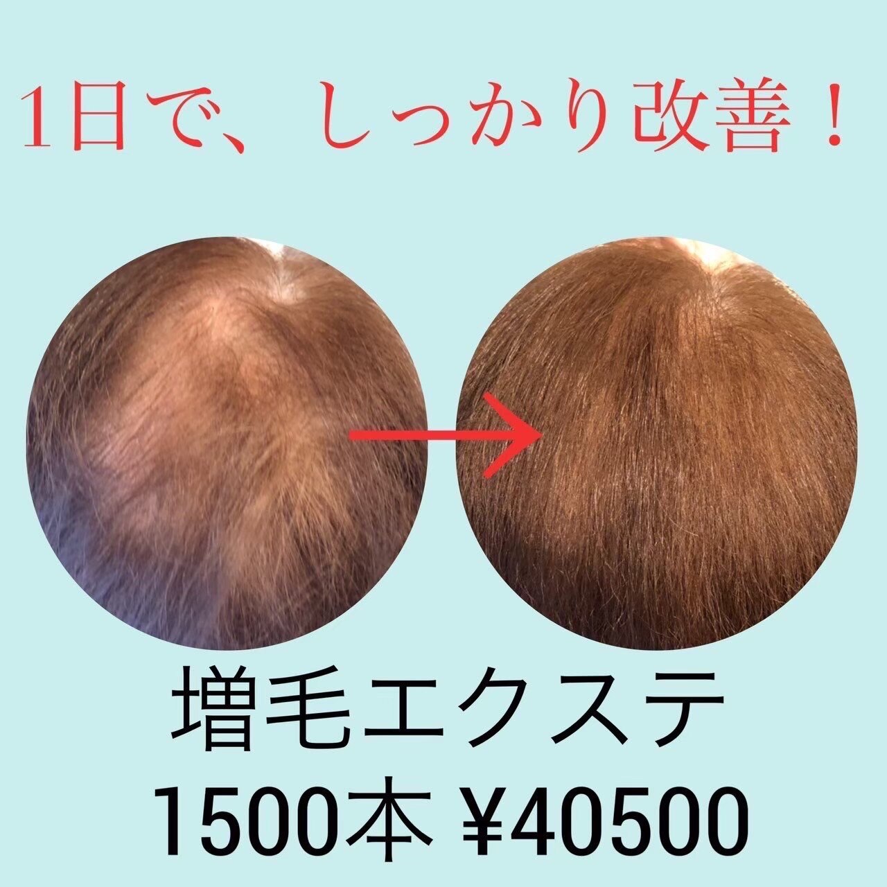 増毛エクステ　2000本 （2セット） お試し！増毛エクステヘアループ☆200本！生え際のボリュームUP